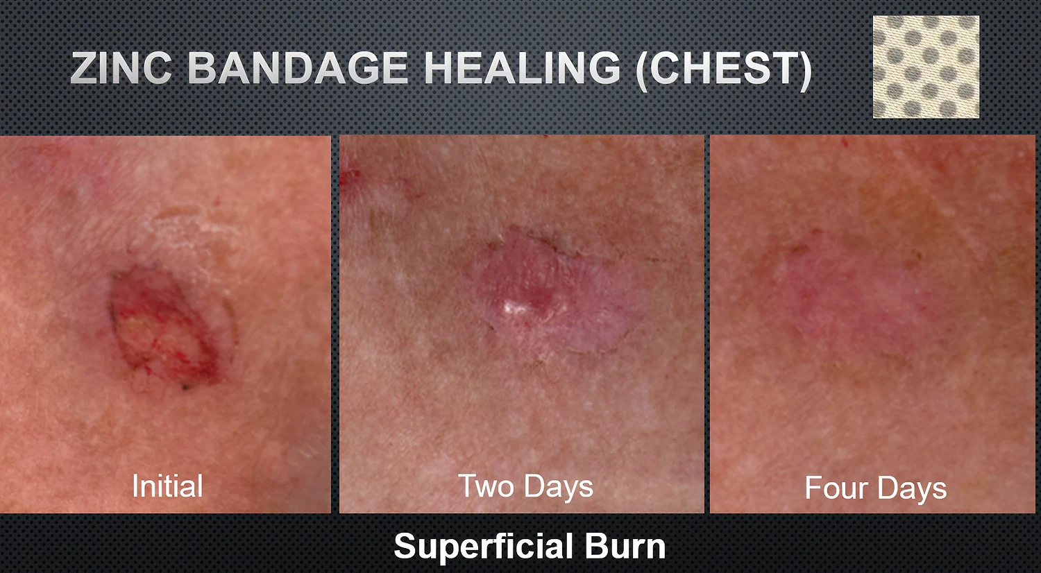 Clinical Photo 3